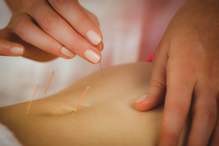 Pelvic Floor Acupuncture….You Put Needles Where??